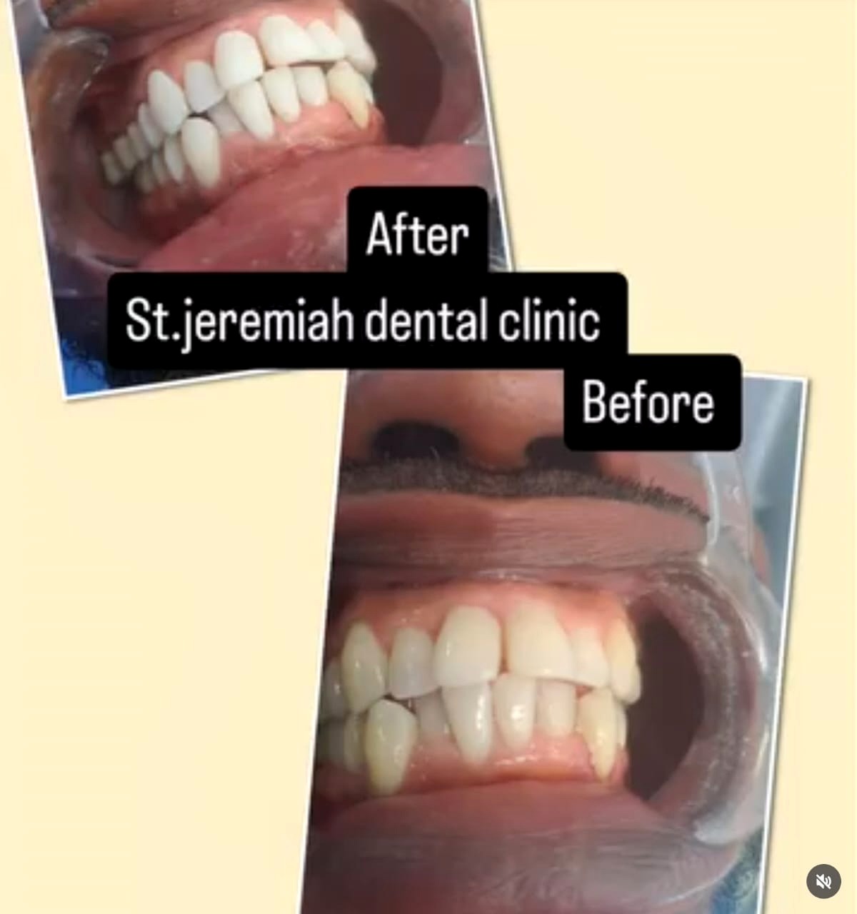 Dental treatment case comparison
