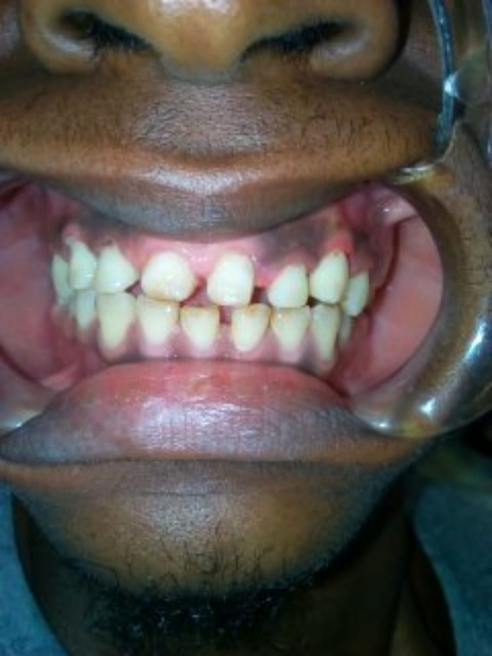 Dental treatment case