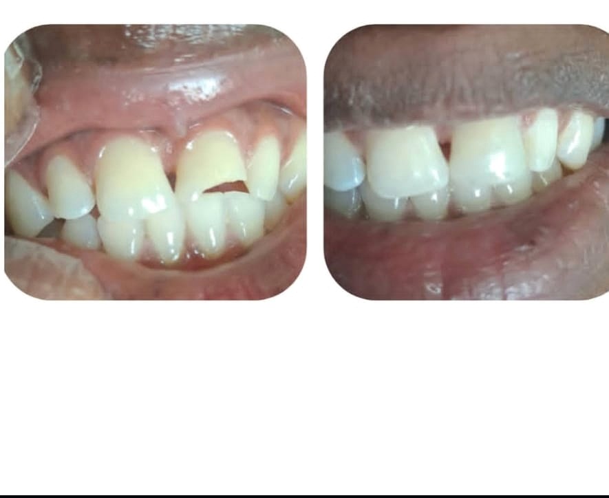 Dental treatment side view